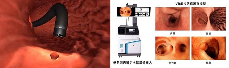 恢复神经的最好方法有哪些(健康复原：神经修复的有效方式探讨)