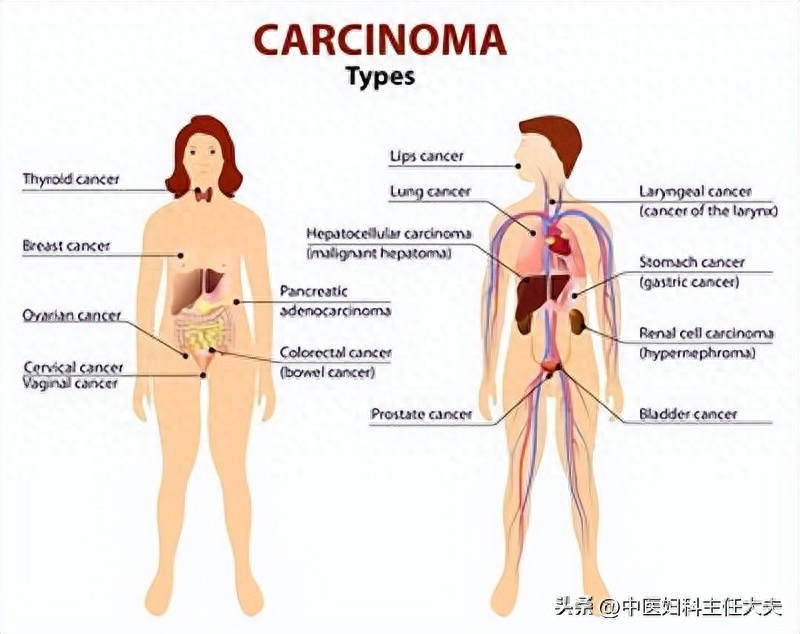 卵巢囊肿最怕三种水果（卵巢囊肿疼痛难忍，平时多吃这几种水果）