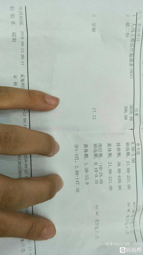 女人怀没怀过孕看三点（介绍判断女性是否怀孕的三个重要指标）